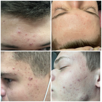 Валерія Соловйова, Ужгород Фото - 10