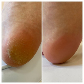 Мар'яна Лакатош, Ивано-Франковск Фото - 5