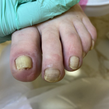 Мар'яна Лакатош, Ивано-Франковск Фото - 7