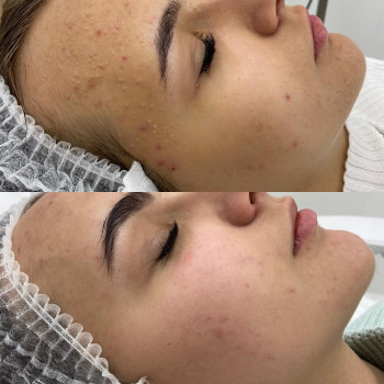 Анна Афонічкіна, Житомир Фото - 4