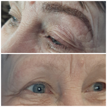 Єлизавета Федорко, Баштанка Фото - 9