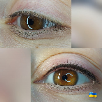 Заповнення міжвійного простору