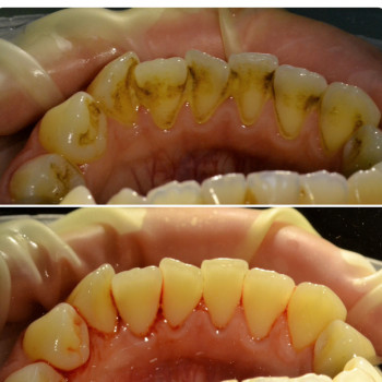 Аліна Степанюк, Рівне Фото - 18