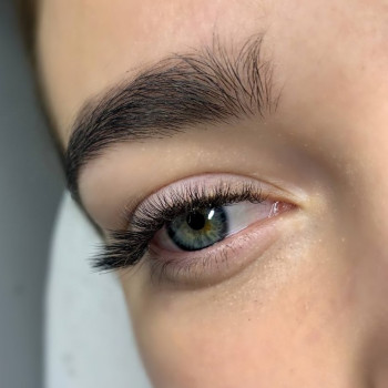 6-12 mm. 
Вигин "М"