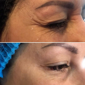 Вікторія Ігнатенко, Київ Фото - 13