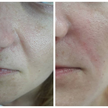 Вікторія Ігнатенко, Київ Фото - 2