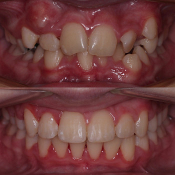 Оля Філіппова, Тернополь Фото - 5