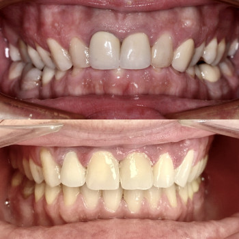 Оля Філіппова, Тернополь Фото - 6