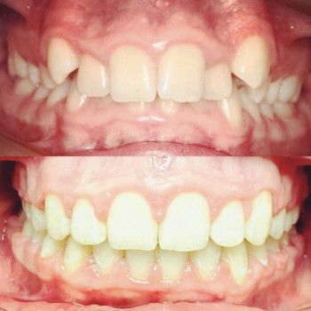 Оля Філіппова, Тернополь Фото - 8