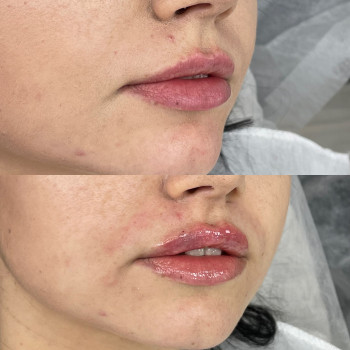 Соломія Гандзюк, Калуш Фото - 5