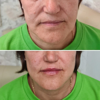 Ирина Булгар, Одесса Фото - 65