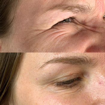 Наталья Окуловская, Київ Фото - 24