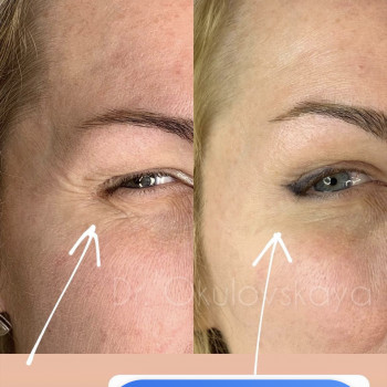 Наталья Окуловская, Київ Фото - 26