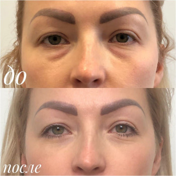 Алексей Чернобай, Вінниця Фото - 5