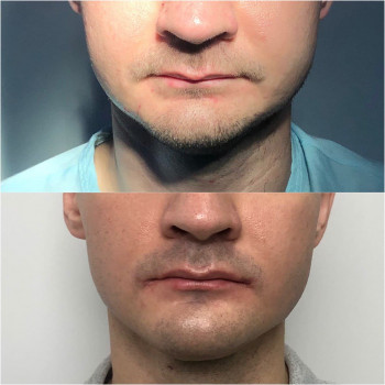 Алексей Чернобай, Вінниця Фото - 9