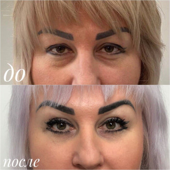 Алексей Чернобай, Вінниця Фото - 10