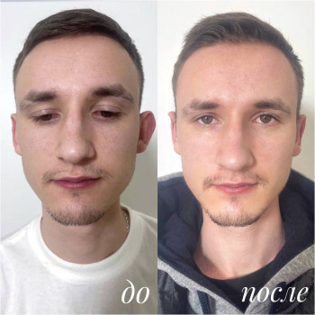 Алексей Чернобай, Вінниця Фото - 13