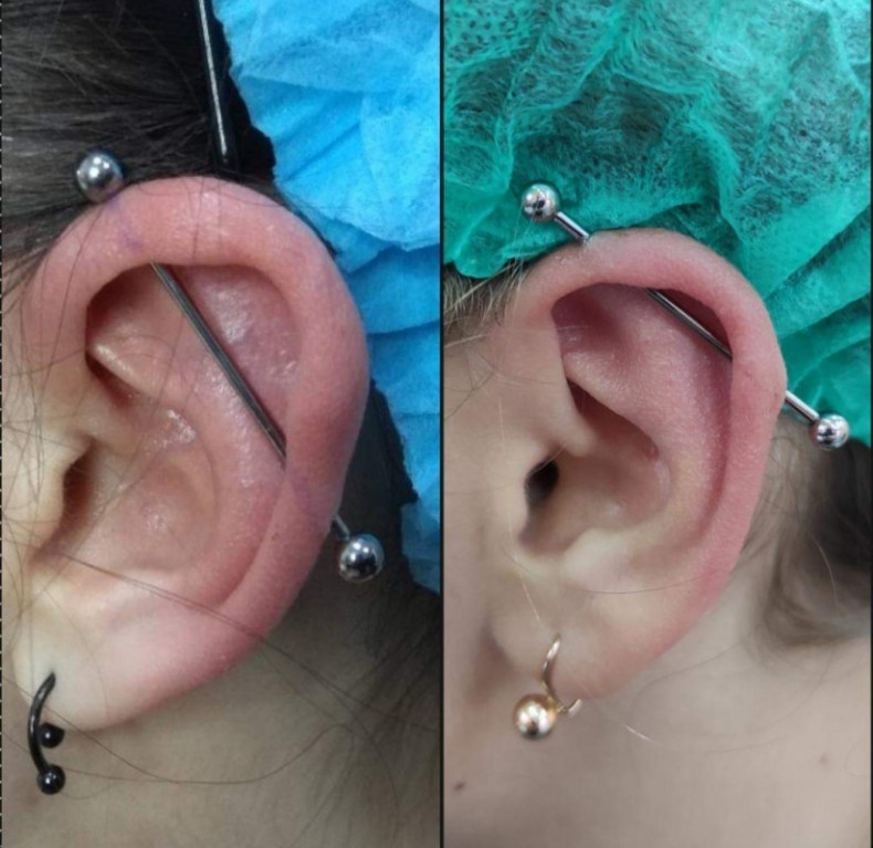 Пирсинг Индастриал, фото - Салон краси Иленто