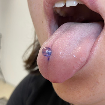 Пирсинг язика. Прикраса входить у вартість.