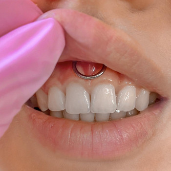 Юлія Филиппова, Кам'янець-Подільський Фото - 41