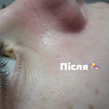 Shinee cosmetology, Ивано-Франковск Фото - 5