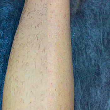 Лиана Безрукова, Сумы Фото - 6