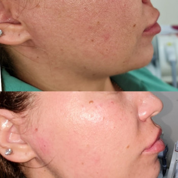 Ирина Булгар, Одесса Фото - 66