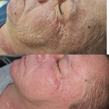 Ирина Булгар, Одесса Фото - 70