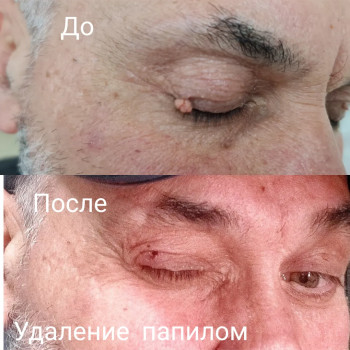 Ирина Булгар, Одесса Фото - 71