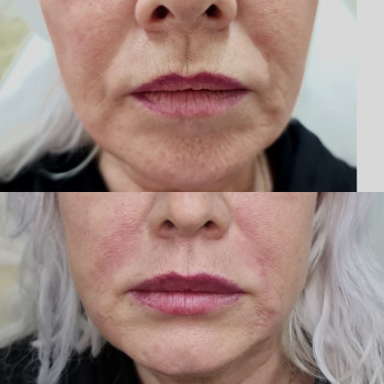 Ирина Булгар, Одесса Фото - 72