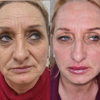 Ирина Булгар, Одесса Фото - 73