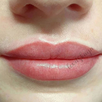 Напыление губ