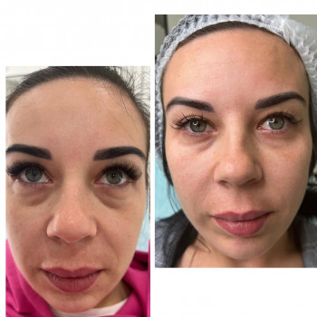 Наталья Грицай, Днепр Фото - 28