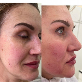 Наталья Грицай, Днепр Фото - 36