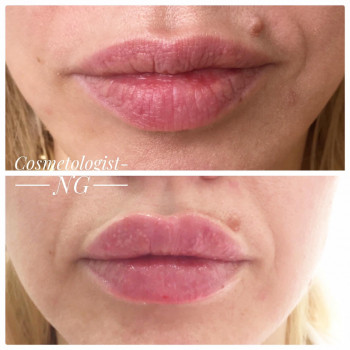 Наталья Грицай, Днепр Фото - 40