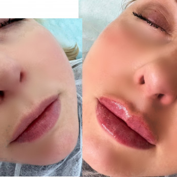 Наталья Грицай, Днепр Фото - 45