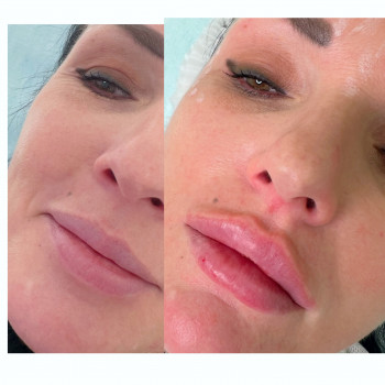 Наталья Грицай, Днепр Фото - 49