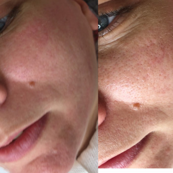 Наталья Грицай, Днепр Фото - 59