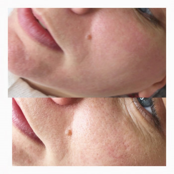 Наталья Грицай, Днепр Фото - 63