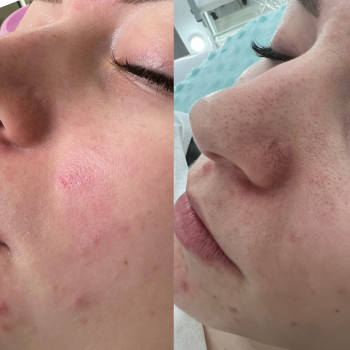 Наталья Грицай, Днепр Фото - 70