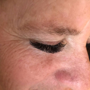 Наращивание на нависшее веко.