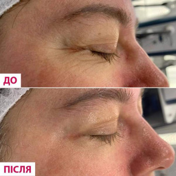 Марія Миколишин, Тернопіль Фото - 5