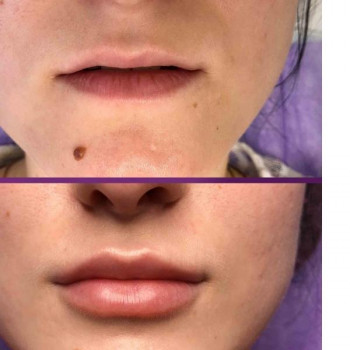 Марія Миколишин, Тернопіль Фото - 6