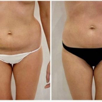 Марія Миколишин, Тернопіль Фото - 7