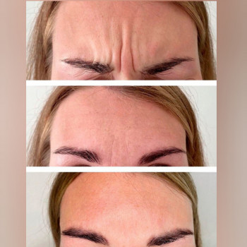 Ирина Булгар, Одесса Фото - 74