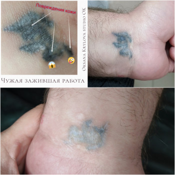 Лазерное удаление тату
                    Мастер перманентного макияжа Оксана Киев