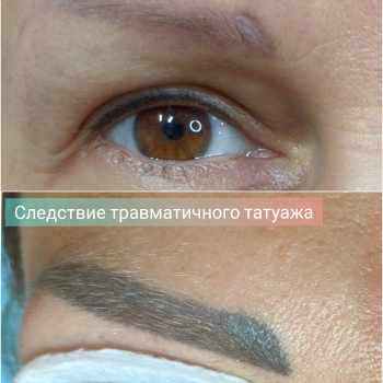 Лазерное удаление тату
                    Мастер перманентного макияжа Оксана Киев