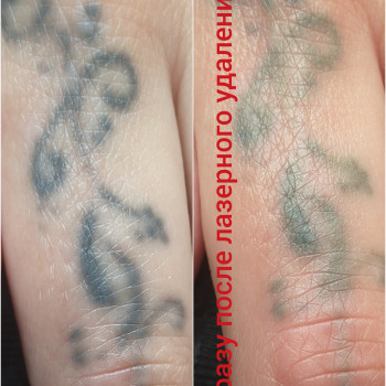 Первая процедура