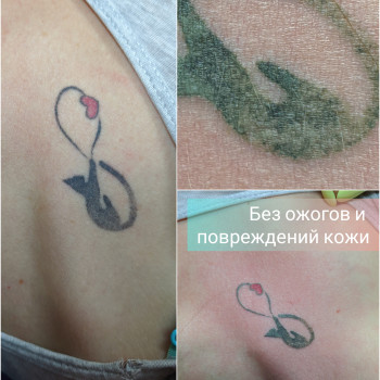 Лазерное удаление тату
                    Мастер перманентного макияжа Оксана Киев