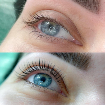 Ламінування вій
                    Бровіст Елена Дніпро